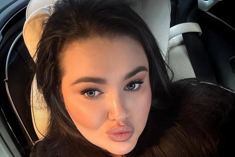 «Мое тело изменилось»: дочь Пригожина объяснила, зачем ей вторая пластическая операция