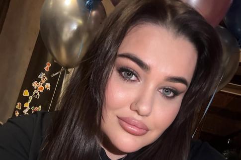 «Не считаю себя героем»: дочь Пригожина показала тело после пластической операции