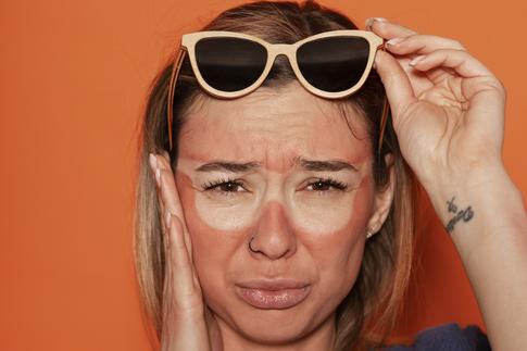 Сметана «не работает»: чем намазать кожу при солнечных ожогах, чтобы снять красноту и боль