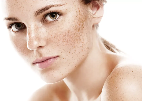 Пятна на солнце: как вернуть коже ровный тон без агрессивных процедур