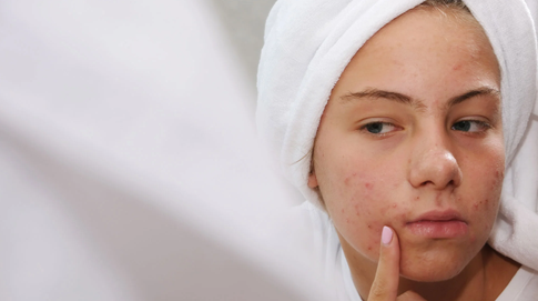 Минимум банок, максимум эффекта: базовый уход за кожей для подростков