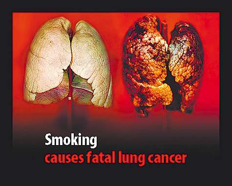 Легкие здорового человека и курильщика.