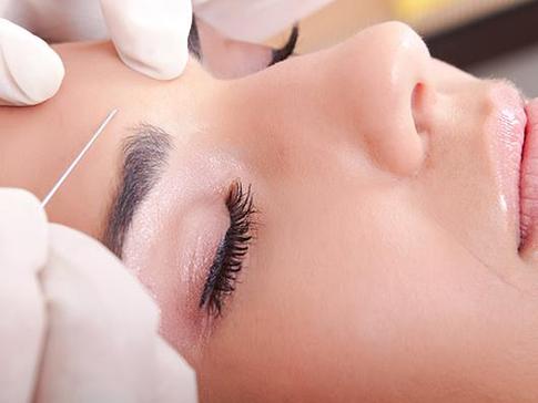 О подтяжке лица: что в лифтинге тебе моем?