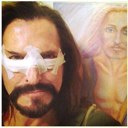 Никита Джигурда сделал пластическую операцию. Фото: Twitter.com.