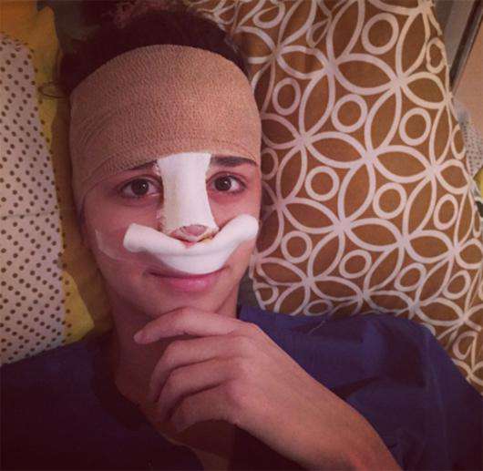 Первое селфи Алианы Гобозовой после операции. Фото: Instagram.com/aliana1001.