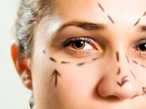 Когда и как использовать интемпоральный лифтинг?