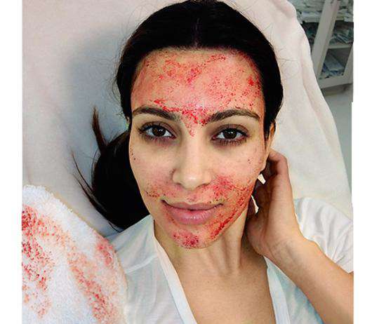 Ким Кардашьян с кровавой маской на лице. Фото: Instagram.com/kimkardashian.