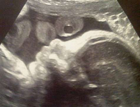 Снимок УЗИ. Фото: Twitter.com.