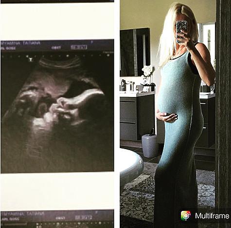 Ягудин опубликовал снимок УЗИ, которое на днях сделала его беременная жена. Фото: Instagram.com/alexei.yagudin.