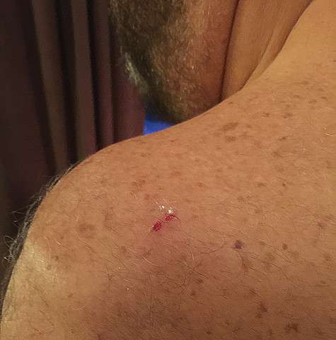 Сильных внешних повреждений Шуфутинскому удалось избежать, но мелкие порезы все же остались на голове и плечах артиста. Фото: материалы пресс-служб. Сильных внешних повреждений Шуфутинскому удалось избежать, но мелкие порезы все же остались на голове и плечах артиста. Фото: материалы пресс-служб.