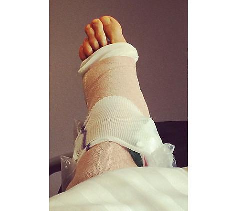 Судя по фото, операция полузащитнику “Локомотива” была сделана на ноге. Супруга Дмитрия Тарасова Ольга Бузова находится с ним в больнице. Фото: Instagram.com/tarasov23.