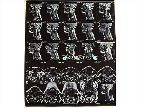 Мария Кожевникова показала подписчикам свои рентгеновские снимки. Фото: Instagram.com/mkozhevnikova.