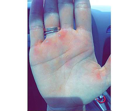 Елена Исинбаева показала трудовые мозоли, полученные на тренировках. Фото: Instagram.com/isinbaevayelena.