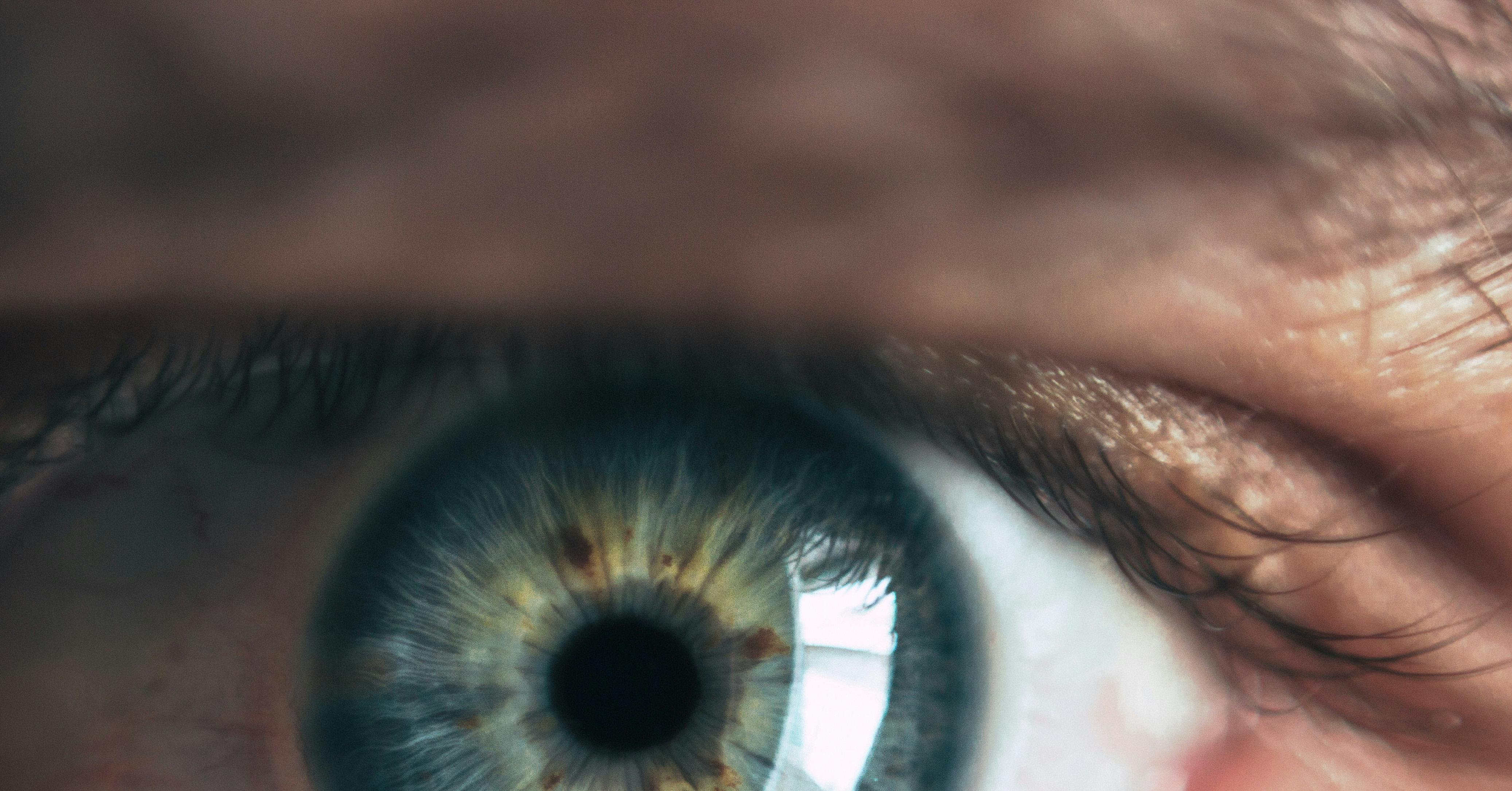 Как сделать слепоты. Культурная слепота. Как сделать слепоты. Здоровые глаза. Заболевания глаз смартфоны.