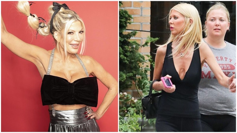 Ошибки пластических хирургов, лишивших Рид, Спеллинг и других звезд красивой груди