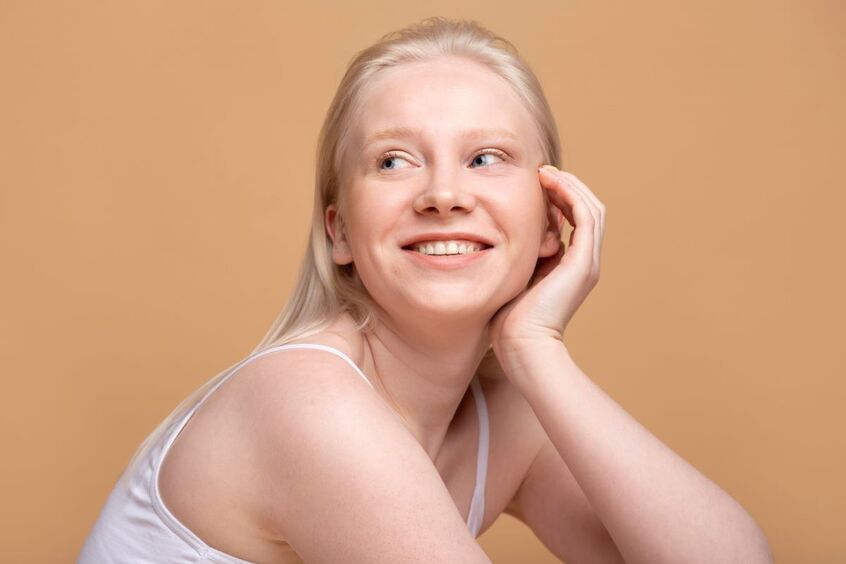 Бледность снова в тренде: 3 причины отказаться от загара