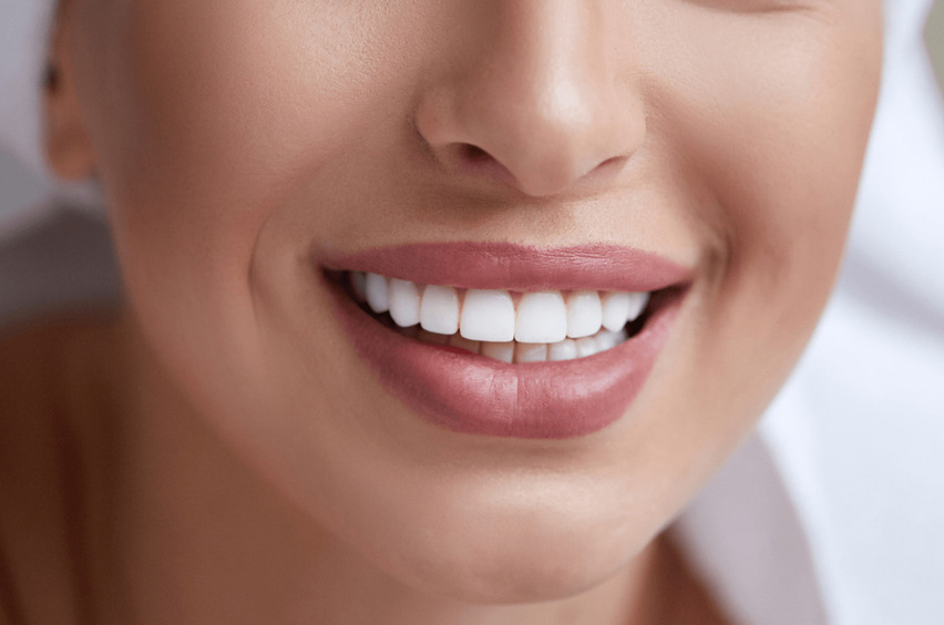 Виниры: 7 мифов о звездном тренде стоматологии
