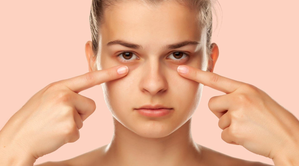 Темные круги под глазами: 7 домашних способов быстро их убрать