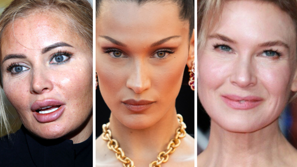 Борисова, Хадид, Зеллвегер: почему звезды стремятся сделать пластику глаз