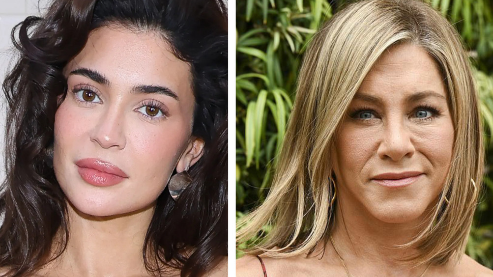 Миграция филлеров: почему лица Энистон и Дженнер опухшие и неровные