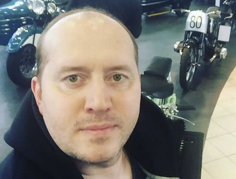 Сергей Бурунов задумался о пересадке волос: «Это целая история»