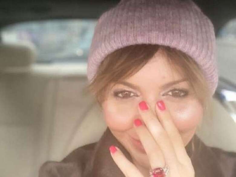 «Хрящи с ушей и часть из ребра»: Алиса Аршавина показала свой новый нос