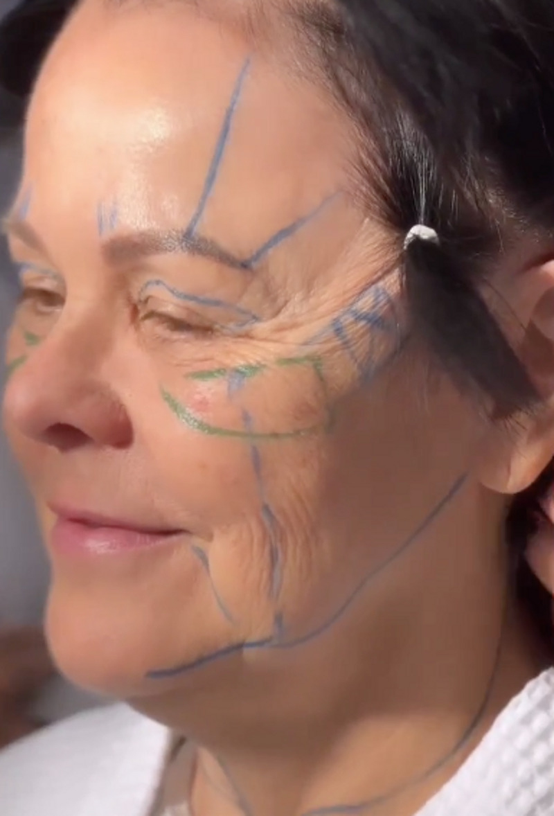 Наталья Медведева показала маму до операции