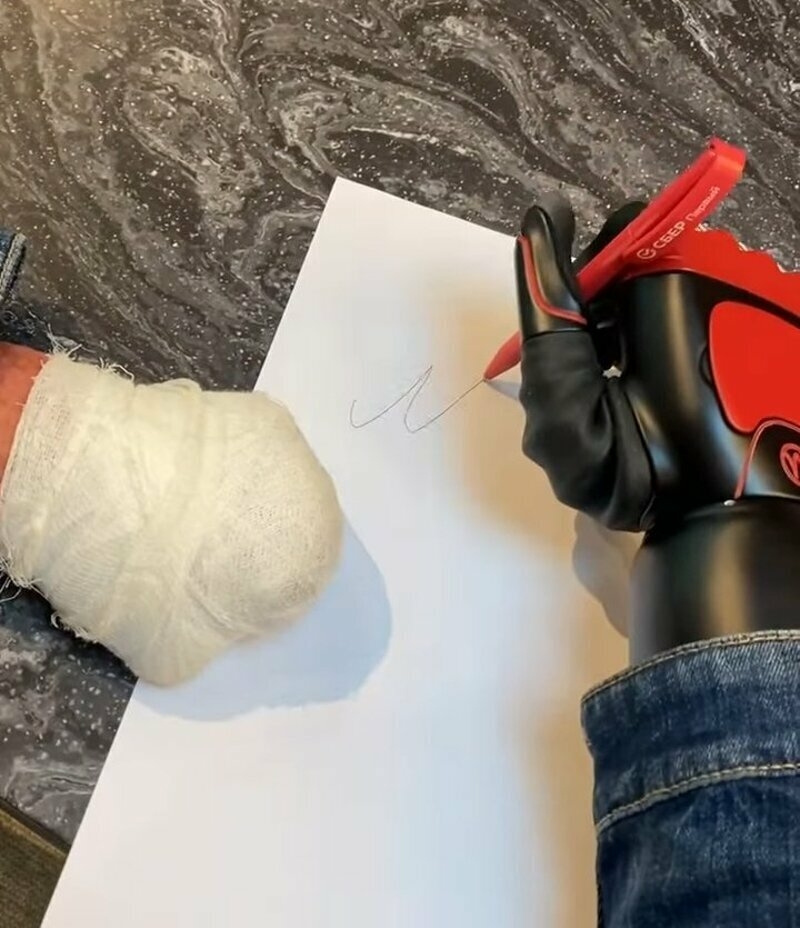 Чудо-рукой спортсмен сможет писать