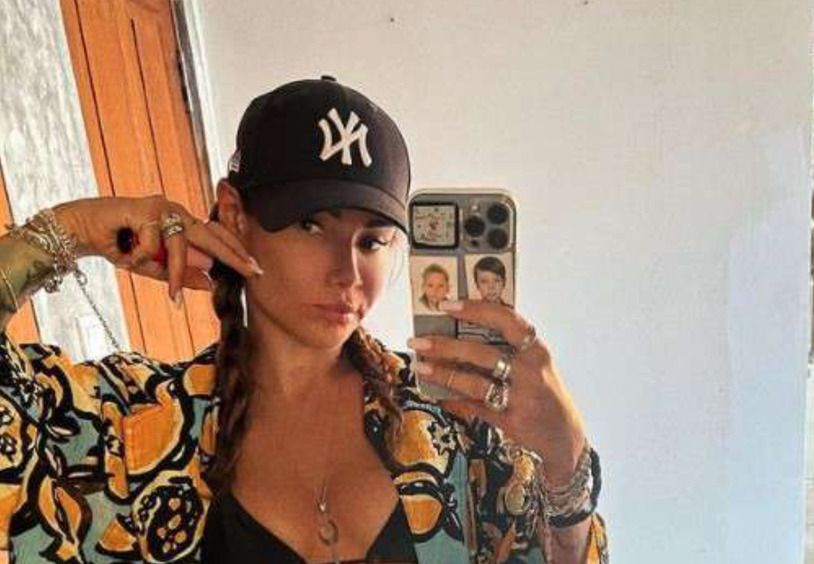 Айза показала себя после недавнего ковида: «У меня брови осыпались, очень много волос выпало»