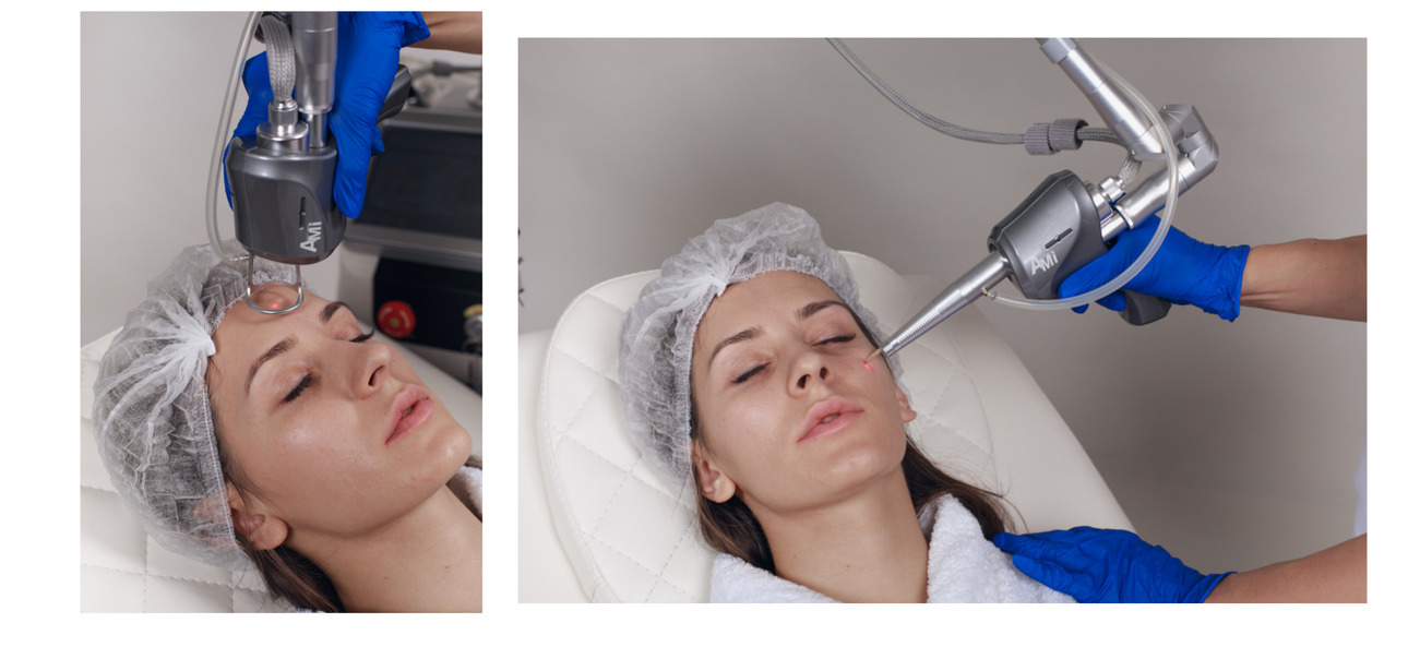 Dermaxel - аппарат известного корейского бренда, существующий на рынке с 1998 года, он популярен более чем в 50 странах. У нас «Омоложение Dermaxel» делают, например, в клинике экспертного класса сети RE:new в районе Шелепихи