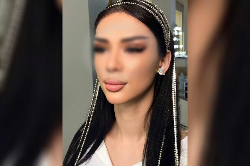 Друзья погибшей во время операции девушки рассказали, что умоляли ее не идти к косметологу