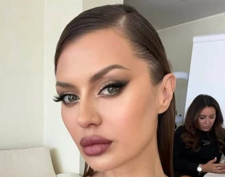 Виктория Боня озвучила сумму за пластическую операцию: как стоимость «однушки»