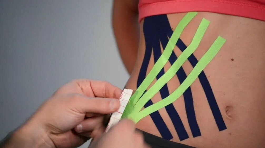 Тейпирование