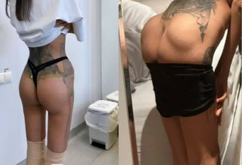 Фото после и до операции Аланы Мамаевой