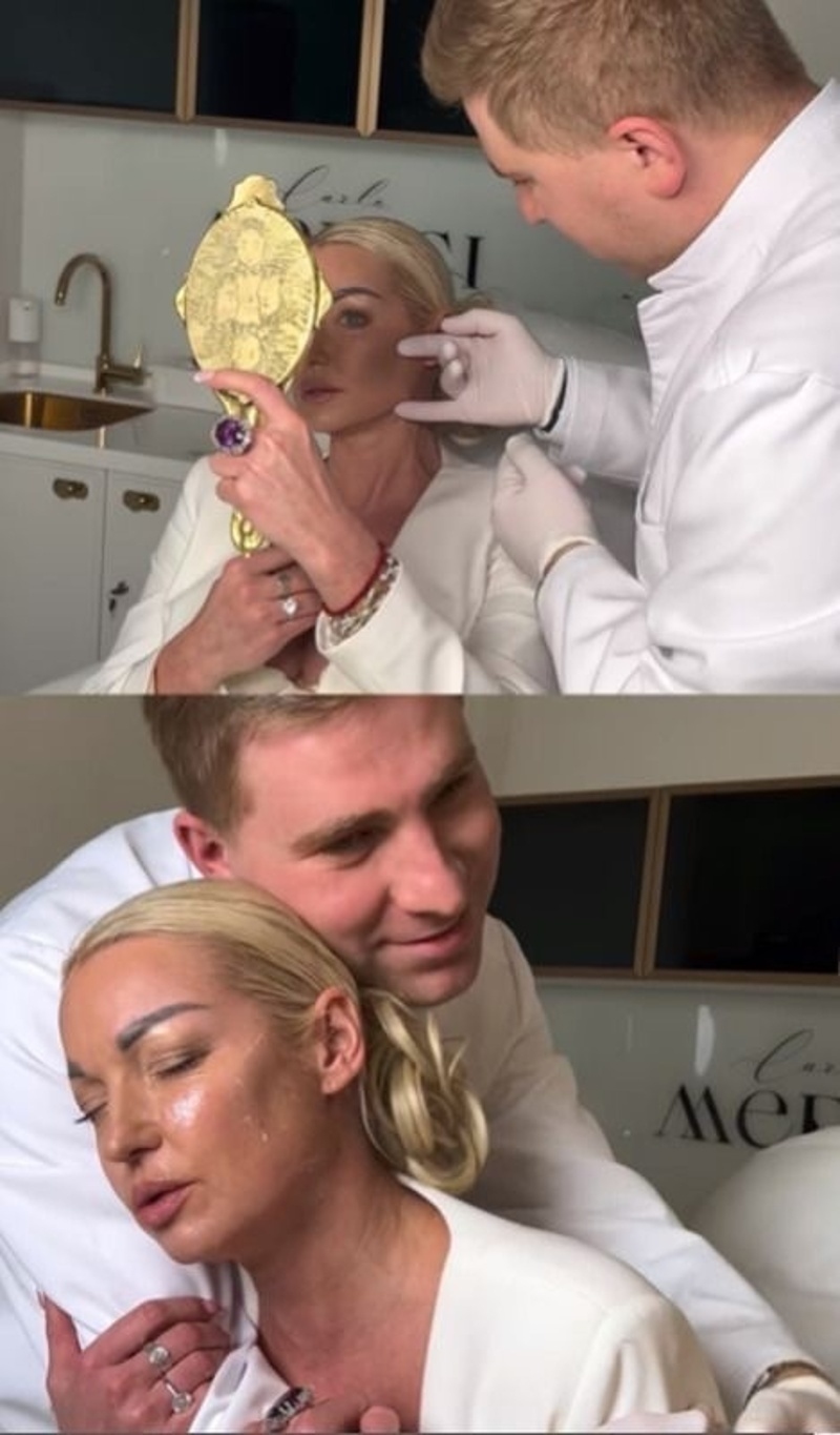 Балерина показала результат до и после процедуры