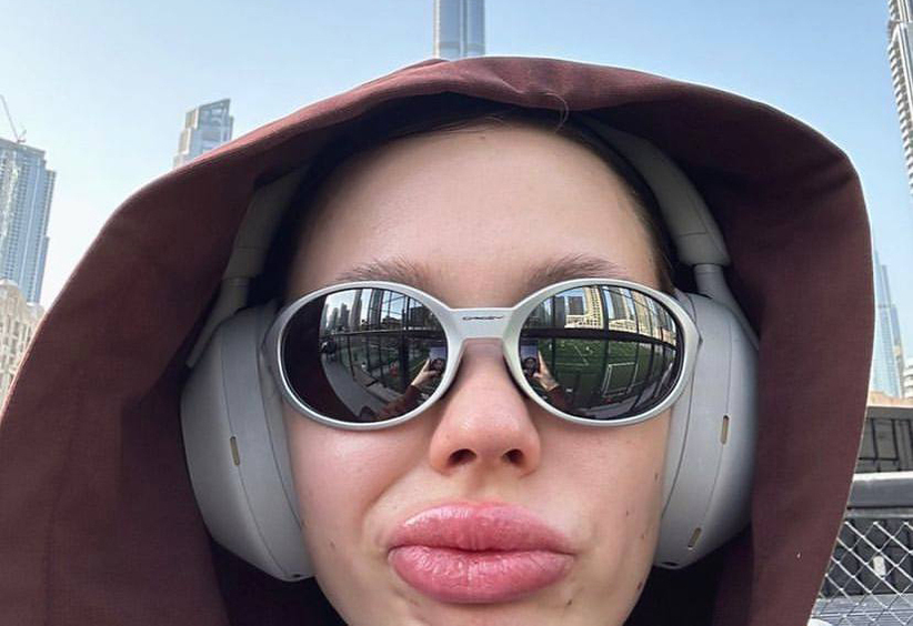 «Ждите мое настоящее лицо»: Инстасамка избавится от «надувных» губ