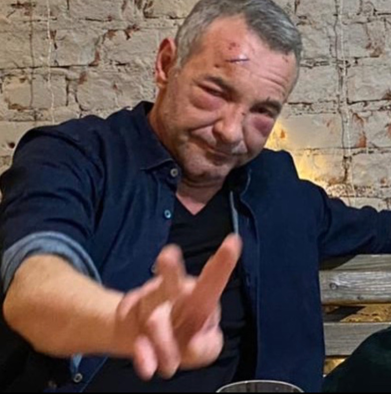 Актера Максима Дрозда изувечил собственный сын