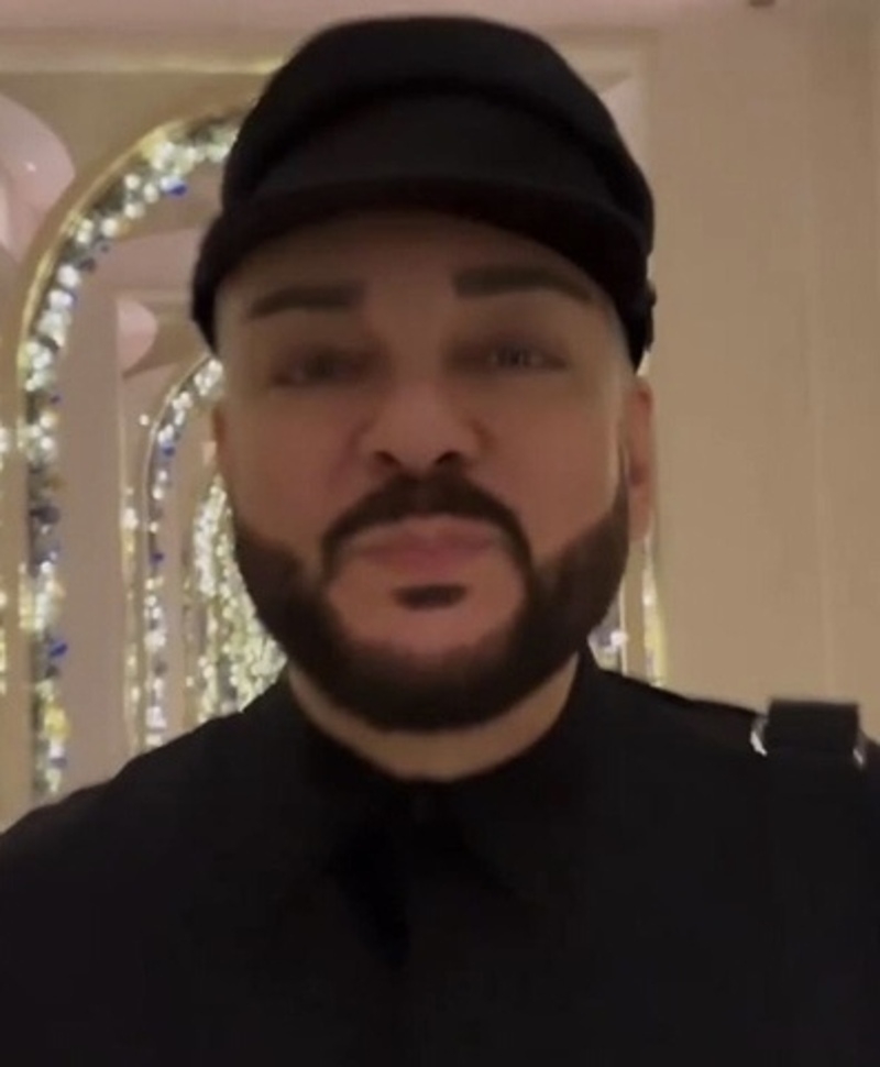 Певец показал свое изменившееся лицо