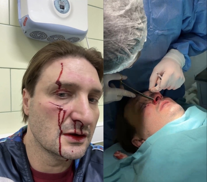 Дрессировщик показал полученные травмы