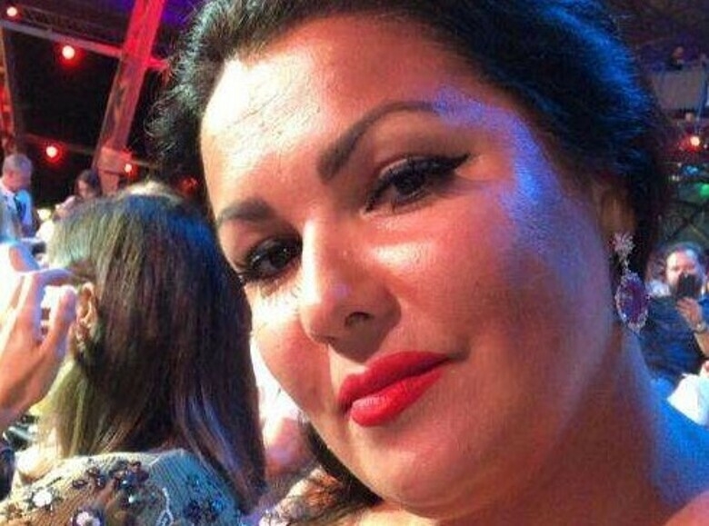 Анна Нетребко