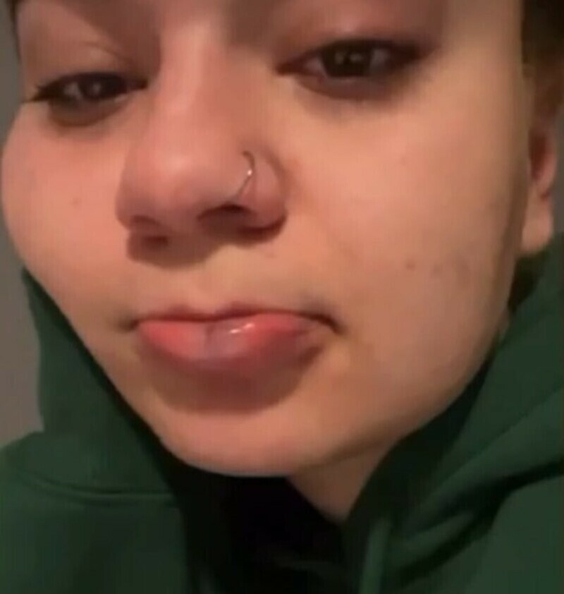 Наследница рэпера показала разбитую губу