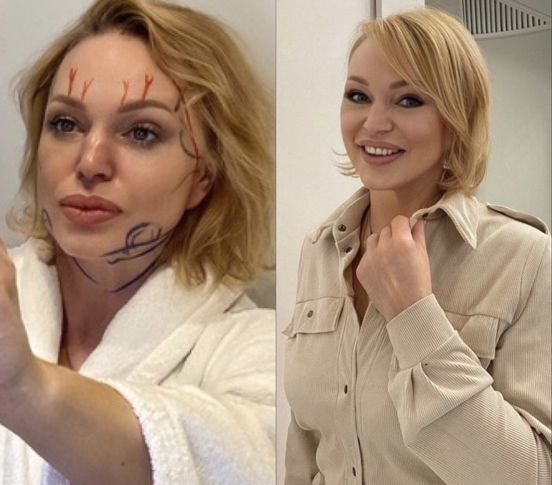 Ведущая показала себя "до" и "после" операции