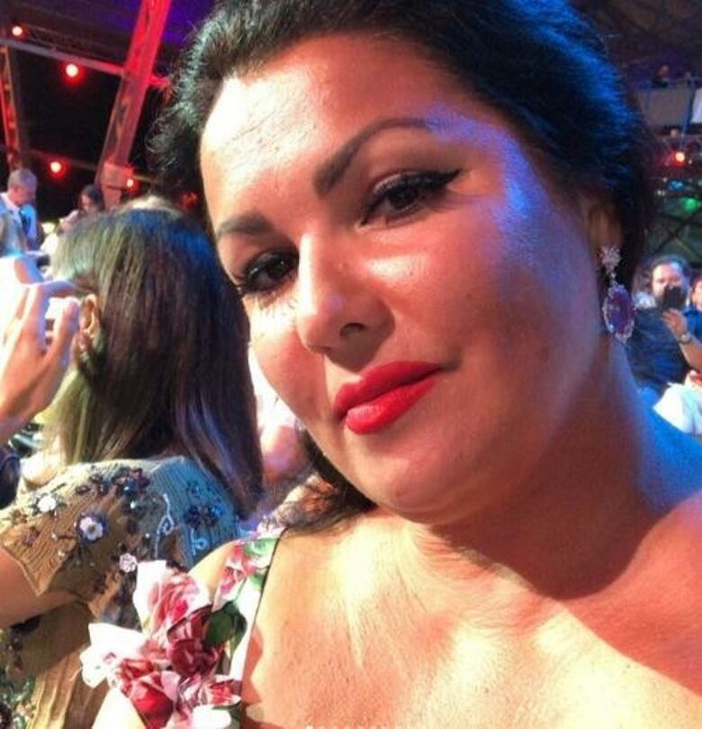 Анна Нетребко