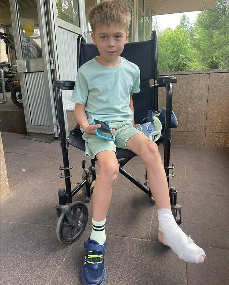 Артемий получил сломал на ноге мизинец