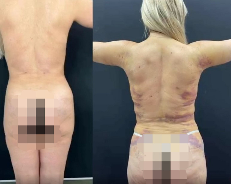 Знаменитость хочет вернуть живот, который был у нее до родов