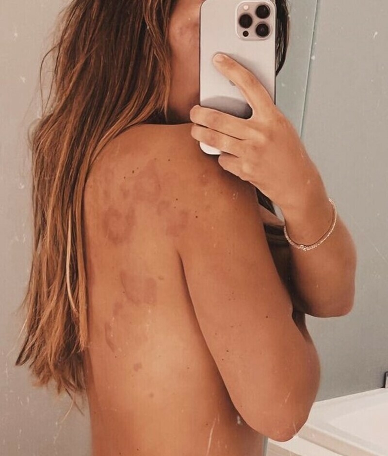 Певица намерена продолжать бороться с недугом