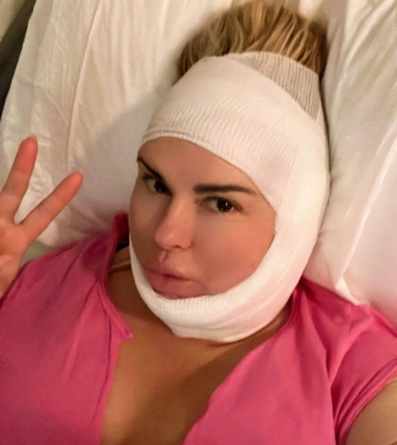 Анна Семенович теперь носит специальную повязку на подбородке