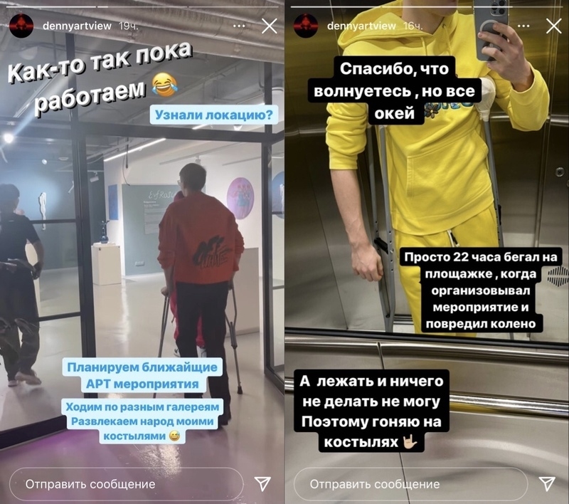 Сын певицы повредил ногу