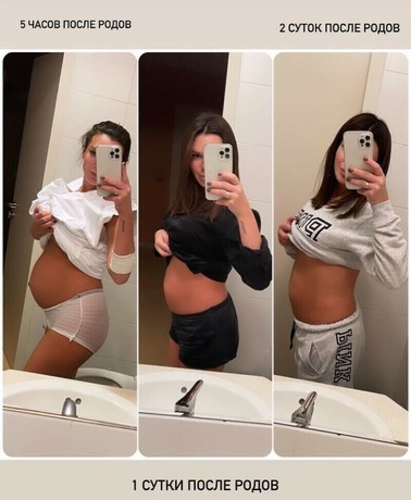 Звезда показала трансформацию своего живота после родов