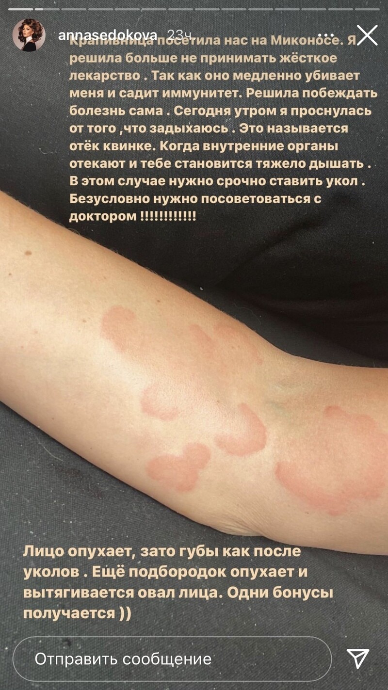 Певица проснулась от того, что стала задыхаться